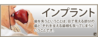 インプラント